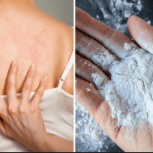 prickly heat powder