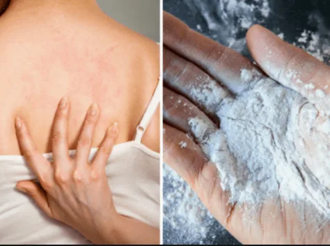 prickly heat powder