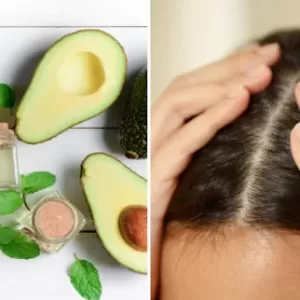 avacado hair growth