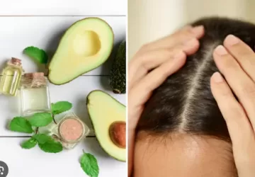 avacado hair growth