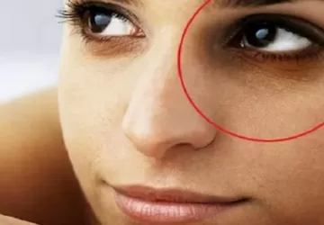 काले घेरे की क्रीम