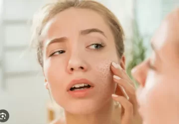 चेहरे की झाइयां