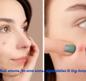 Serums for Acne Scars