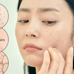 rejuran skin therapy