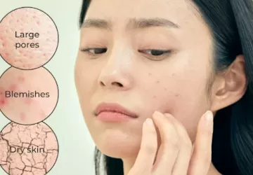 rejuran skin therapy