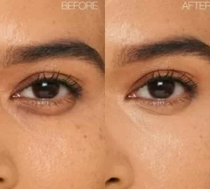 under-eye brightene