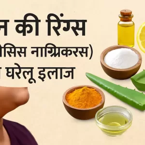 गर्दन की रिंग्स