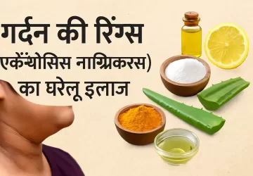 गर्दन की रिंग्स