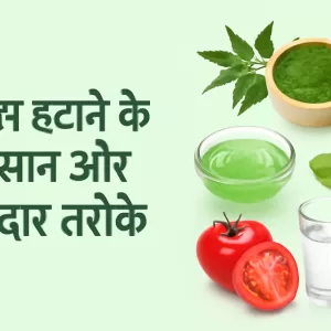 पिंपल्स हटाने