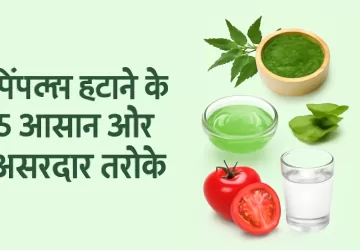 पिंपल्स हटाने