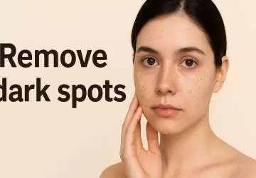 चेहरे से काले धब्बे हटाने के लिए