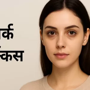 डार्क सर्कल्स से छुटकारा