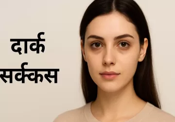 डार्क सर्कल्स से छुटकारा