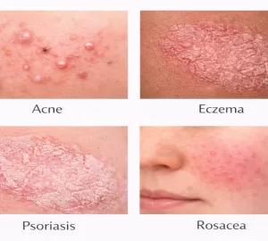 Complete Guide to Skin Diseases Types, Causes & Expert Insights