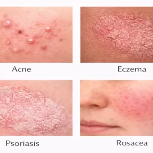 Complete Guide to Skin Diseases Types, Causes & Expert Insights