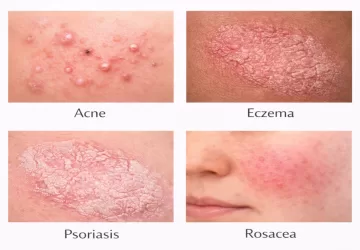 Complete Guide to Skin Diseases Types, Causes & Expert Insights